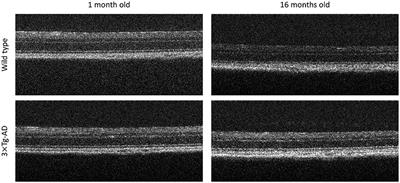 Retinal Aging in 3× Tg-AD Mice Model of Alzheimer's Disease